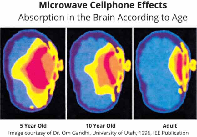 Efectos de la radiación en el cerebro