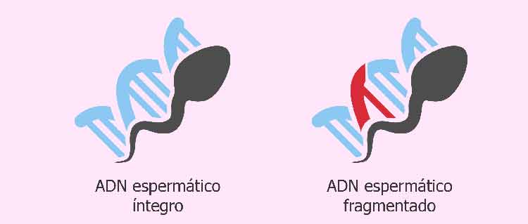 Fragmentación del ADN del espermatozoide